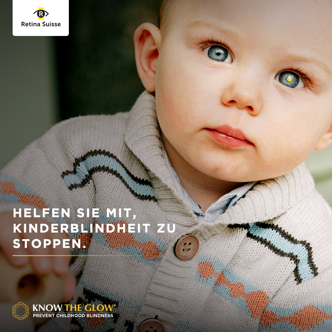 Kleines Kind mit einer weissen Stickjacke mit blauen und orangen Streifen. Das Kind hat blaue Augen, im linken Auge ist ein weissliches Aufleuchten zu sehen. Unten links steht "Helfen Sie mit, Kinderblindheit zu stoppen."